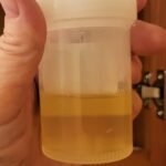 When Sanctions Sting: Belarus Drinks to Health with Urine Therapy